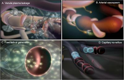 Contribution of microvascular dysfunction to chronic pain